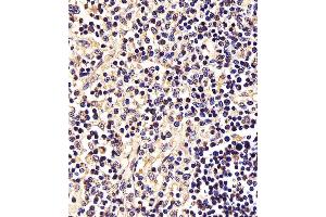 (ABIN6242561 and ABIN6577995) staining STAT5A in Human thymus tissue sections by Immunohistochemistry (IHC-P - paraformaldehyde-fixed, paraffin-embedded sections).
