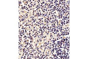 (ABIN6242561 and ABIN6577995) staining STAT5A in Human thymus tissue sections by Immunohistochemistry (IHC-P - paraformaldehyde-fixed, paraffin-embedded sections). (STAT5A anticorps  (C-Term))