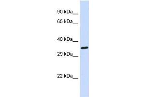 Host: Rabbit Target Name: EWSR1 Sample Type: 721_B Whole cell lysates Antibody Dilution: 1. (EWSR1 anticorps  (C-Term))