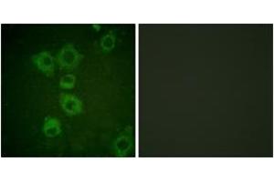 Immunofluorescence analysis of HuvEc cells, using Caspase 6 (Ab-257) Antibody. (Caspase 6 anticorps  (AA 223-272))