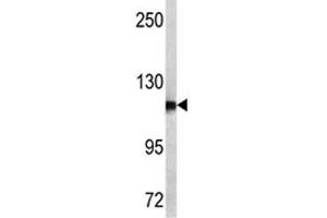 Western blot analysis of NPEPPS antibody and MCF-7 lysate.
