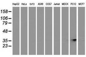 Image no. 3 for anti-Retinol Dehydrogenase 14 (All-Trans/9-Cis/11-Cis) (RDH14) antibody (ABIN1500656) (RDH14 anticorps)