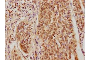 anti-Casein Kinase 2, alpha 3 Polypeptide (CSNK2A3) (AA 151-391) antibody