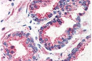 Prostate, Human: Formalin-Fixed, Paraffin-Embedded (FFPE)