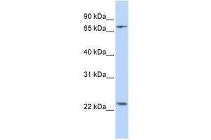 Western Blotting (WB) image for anti-Zinc Finger Protein 185 (ZNF185) antibody (ABIN2458345) (Zinc Finger Protein 185 anticorps)