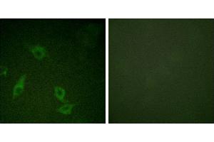 Peptide - +Immunofluorescence analysis of HeLa cells, using FAK (Ab-397) antibody. (FAK anticorps  (Tyr397))
