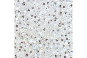 Immunohistochemistry of paraffin-embedded Mouse liver using CEBPA Rabbit pAb (ABIN6131380, ABIN6138380, ABIN6138381 and ABIN6214018) at dilution of 1:100 (40x lens). (CEBPA anticorps  (AA 1-205))