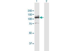 Western Blot analysis of LIG4 expression in transfected 293T cell line by LIG4 MaxPab polyclonal antibody. (LIG4 anticorps  (AA 1-911))