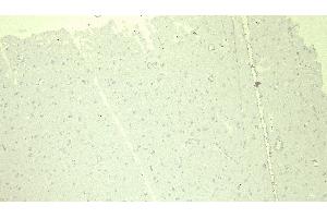 (ABIN184570) Negative Control showing staining of paraffin embedded Human Cortex, with no primary antibody. (DDB1 anticorps  (C-Term))