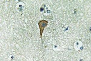 Immunohistochemistry (IHC) analyzes of IL-20Ralpha antibody in paraffin-embedded human brain tissue. (IL20RA anticorps)