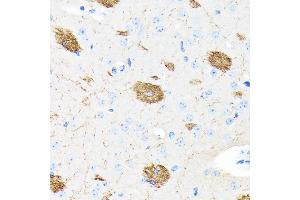 Immunohistochemistry of paraffin-embedded mouse brain using APP Rabbit mAb (ABIN7265575) at dilution of 1:100 (40x lens). (APP anticorps)