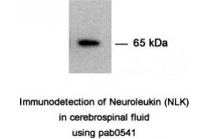 Image no. 1 for anti-Glucose-6-Phosphate Isomerase (GPI) antibody (ABIN347737) (GPI anticorps)