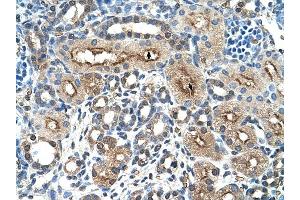 CLEC4M antibody was used for immunohistochemistry at a concentration of 4-8 ug/ml to stain Epithelial cells of renal tubule (arrows) in Human Kidney. (C-Type Lectin Domain Family 4, Member M (CLEC4M) (N-Term) anticorps)