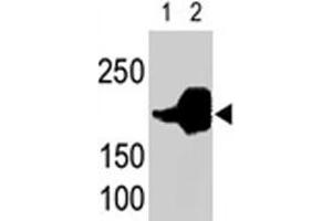 LRP5 polyclonal antibody  is used in Western blot to detect recombinant human LRP5 (Lane 1) and mouse LRP5 (Lane 2) proteins in transfected 293 cell lysates. (LRP5 anticorps  (C-Term))