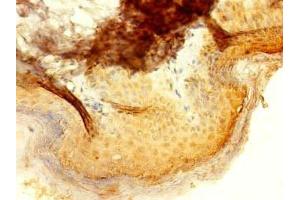 anti-Interferon-Induced Protein with Tetratricopeptide Repeats 5 (IFIT5) (AA 107-320) antibody
