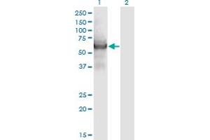 Western Blot analysis of CEP55 expression in transfected 293T cell line by CEP55 monoclonal antibody (M05), clone 6A10.