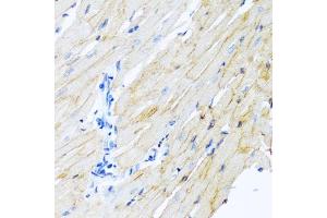 Immunohistochemistry of paraffin-embedded rat heart using ADAM17 antibody. (ADAM17 anticorps)