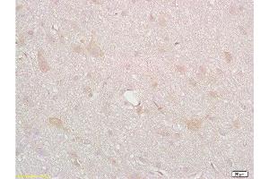 Formalin-fixed and paraffin embedded rat brain tissue labeled with Anti-DRD2 Polyclonal Antibody, Unconjugated  at 1:200, followed by conjugation to the secondary antibody and DAB staining