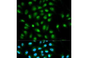 Immunofluorescence analysis of HeLa cells using ASC / TMS1 Polyclonal Antibody (PYCARD anticorps)