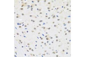 Immunohistochemistry of paraffin-embedded mouse brain using SAFB2 antibody.