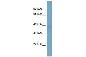 WB Suggested Anti-CXorf66 Antibody Titration:  0. (CXorf66 anticorps  (Middle Region))