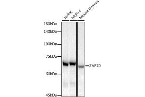 Western blot analysis of extracts of various cell lines, using Z antibody (ABIN7271430) at 1:1000 dilution. (ZAP70 anticorps)