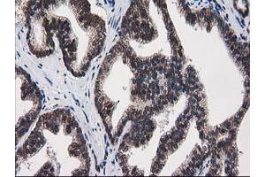 Image no. 1 for anti-Protein Kinase C, epsilon (PRKCE) antibody (ABIN1500228)