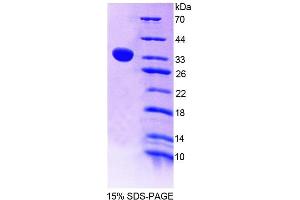 SDS-PAGE analysis of Human THYN1 Protein.