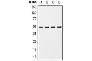 Western blot analysis of CHRNA7 expression in HepG2 (A), Jurkat (B), Raw264. (CHRNA7 anticorps  (Center))