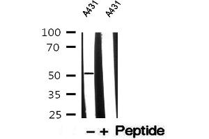 Western blot analysis of A431 whole cell lysates, using Cytokeratin 13 Antibody.