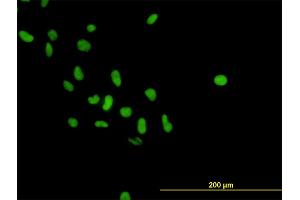 Immunofluorescence of monoclonal antibody to PARP1 on HeLa cell. (PARP1 anticorps  (AA 1-100))
