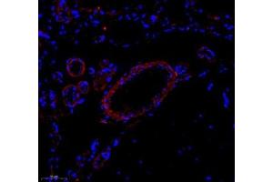 Immunofluorescence of paraffin embedded rat brain using Enfb3 (ABIN7073845) at dilution of 1: 600 (250x lens)