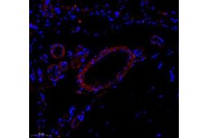 Immunofluorescence of paraffin embedded rat brain using Enfb3 (ABIN7073845) at dilution of 1: 600 (250x lens) (Ephrin B3 anticorps)