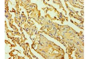 Immunohistochemistry of paraffin-embedded human lung tissue using ABIN7142626 at dilution of 1:100 (Serotonin Receptor 2B anticorps  (AA 382-481))