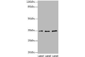 Western blot All lanes: AZGP1 antibody at 4 μg/mL Lane 1: PC-3 whole cell lysate Lane 2: HepG2 whole cell lysate Lane 3: K562 whole cell lysate Secondary Goat polyclonal to rabbit IgG at 1/10000 dilution Predicted band size: 35 kDa Observed band size: 35 kDa (AZGP1 anticorps  (AA 61-210))