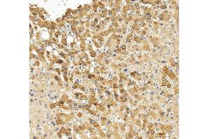 IHC analysis of CYP1A2 using anti-CYP1A2 antibody (ABIN3043820).