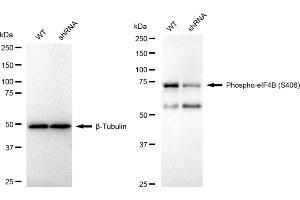 Western blotting analysis using Phospho-eIF4B (S406) antibody (ABIN7798527). (Recombinant EIF4B anticorps  (pSer406))