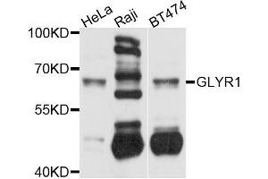 Western blot analysis of extracts of various cell lines, using GLYR1 antibody (ABIN5996127) at 1/1000 dilution. (GLYR1 anticorps)
