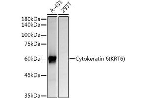 Western blot analysis of extracts of various cell lines, using Cytokeratin 6 (KRT6) Rabbit pAb antibody (ABIN6129605, ABIN6143033, ABIN6143034 and ABIN6223467) at 1:1000 dilution. (KRT6A anticorps  (AA 305-564))