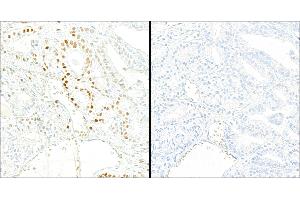 Immunohistochemistry (IHC) image for anti-Tripartite Motif Containing 28 (TRIM28) (pSer824) antibody (ABIN7454038) (Recombinant KAP1 anticorps  (pSer824))