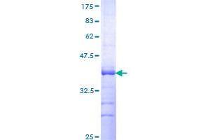 Image no. 1 for G Protein-Coupled Receptor, Family C, Group 5, Member D (GPRC5D) (AA 261-345) protein (GST tag) (ABIN1355651)
