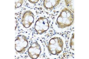 Immunohistochemistry of paraffin-embedded human colon using IFI44 antibody (ABIN5974803) at dilution of 1/100 (40x lens). (IFI44 anticorps)