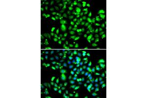 Immunofluorescence analysis of U20S cell using GBP1 antibody.