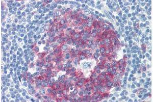 Human Tonsil (formalin-fixed, paraffin-embedded) stained with NCOA3 antibody ABIN462179 followed by biotinylated goat anti-rabbit IgG secondary antibody ABIN481713, alkaline phosphatase-streptavidin and chromogen.