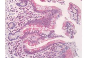 Human Small Intestine: Formalin Fixed, Paraffin Embedded (FFPE)