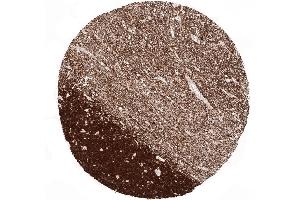 A strong NSE immunostaining is seen in the granule cell layer and in the fibres of the white matter of the cerebellum