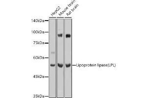 Western blot analysis of extracts of various cell lines, using Lipoprotein lipase (LPL) antibody (ABIN7268286) at 1:1000 dilution. (Lipoprotein Lipase anticorps  (AA 124-475))