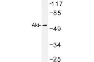 Image no. 1 for anti-V-Akt Murine Thymoma Viral Oncogene Homolog 1 (AKT1) antibody (ABIN317784) (AKT1 anticorps)