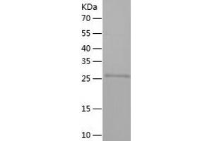 Western Blotting (WB) image for Heme Oxygenase (Decycling) 1 (HMOX1) (AA 1-261) protein (His-IF2DI Tag) (ABIN7123291)