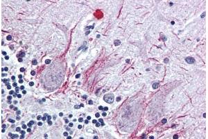 Brain, cerebellum, Human: Formalin-Fixed, Paraffin-Embedded (FFPE)